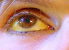 Чувствам се добре и малко по-здрав отпреди