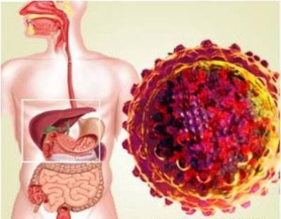 Какво може и не може да се яде при остър хепатит?
