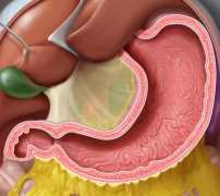 Какво представлява фистула на жлъчката?