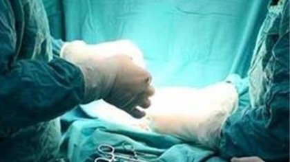 Кистозни заболявания на черния дроб