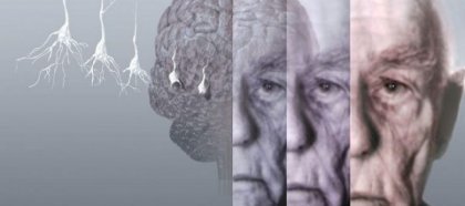 Деменцията и съдовите проблеми са много общи