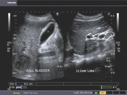 Без капките Хепавитал не тръгвам никъде!