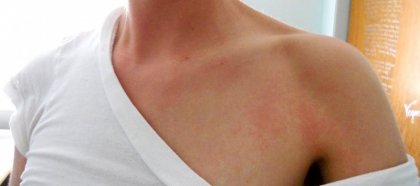 Ако ви е скъпо здравето, направете прочистване с капките Хепавитал!