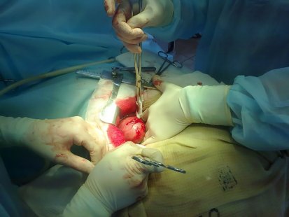 Панкреасът се разболява пръв, ако черния дроб не работи нормално