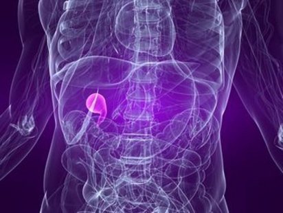 Какво е хроничен холецистит?