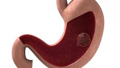 Как да се идентифицират заболяванията на жлъчния мехур