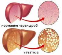 Капките Хепавитал ползвам при стеатоза