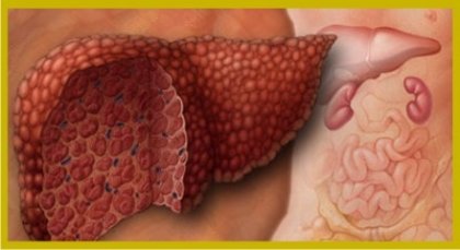 Защо алкохолът е опасен за черния дроб?