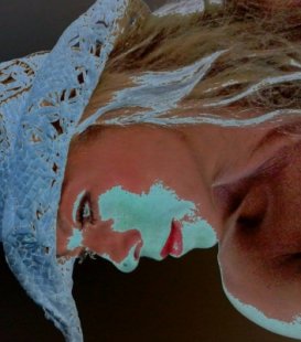 Не помислих за здравето си навреме и си изпатих!