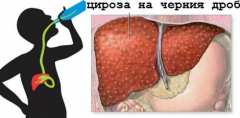 Лошото време увеличава риска за цироза