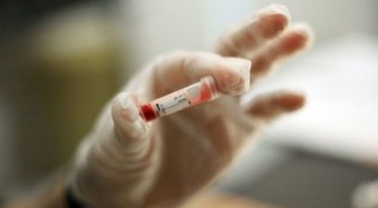 Алкохолът може да доведе до седем вида рак