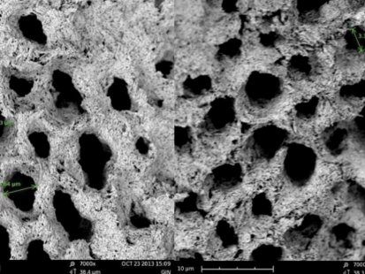 Ето как алкохолът разваля емайла на зъбите!