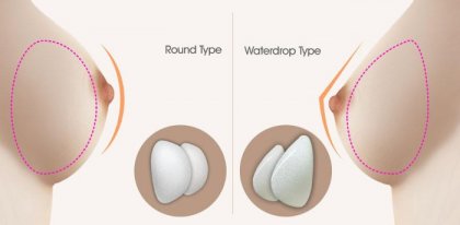 Увеличаването на гърдите може да доведе до развитие на рядко заболяване