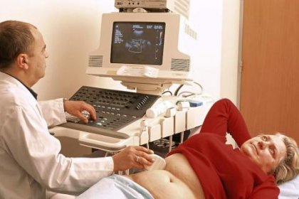 Неусложнен камък в холедоха с остра холестаза