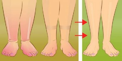 Как да се отървете от килограмите, натрупани заради задържане на вода