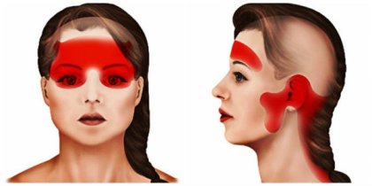 Главоболието и мигрената са болестите на века