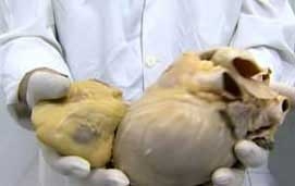 Бирата не е безобидна – тя вреди на сърцето