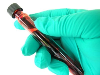 Анемията ми се влоши, щом започнах да прекалявам с алкохола