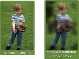 diabetna-retinopatiq
