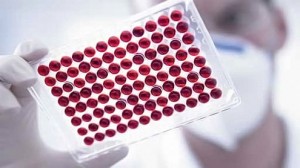 диабет вредни последици