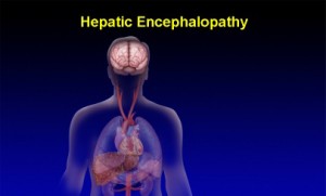 чернодробната енцефалопатия