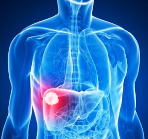 черния дроб грижа