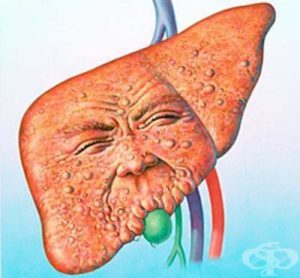 при стеатоза