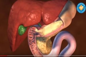 метеоризъм