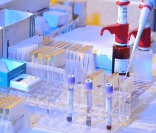 Опасна комбинация за черния дроб – алкохол + наднормено тегло