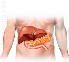 Остър панкреатит – прогнози и лечение
