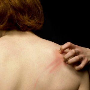 Защо сърбежът е силен при болен черен дроб?